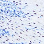 Phospho-STAT1 (Ser727) Antibody in Immunohistochemistry (Paraffin) (IHC (P))