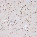 Phospho-ERK1 (Tyr204) Antibody in Immunohistochemistry (Paraffin) (IHC (P))