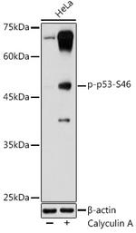 Phospho-p53 (Ser46) Antibody in Western Blot (WB)