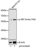 Phospho-SRC (Tyr416) Antibody in Western Blot (WB)