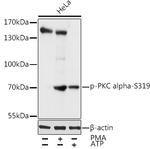 Phospho-PKC alpha (Ser319) Antibody in Western Blot (WB)