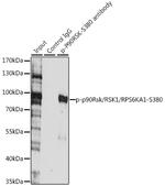 Phospho-RSK1 (Ser380) Antibody in Immunoprecipitation (IP)