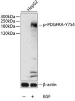 Phospho-PDGFRA (Tyr754) Antibody in Western Blot (WB)