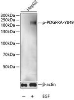 Phospho-PDGFRA (Tyr849) Antibody in Western Blot (WB)