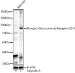 Phospho-Glucocorticoid Receptor (Ser211) Antibody in Western Blot (WB)