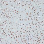 Phospho-p53 (Ser33) Antibody in Immunohistochemistry (Paraffin) (IHC (P))