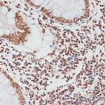 Phospho-p53 (Ser33) Antibody in Immunohistochemistry (Paraffin) (IHC (P))