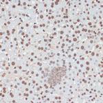 Phospho-p53 (Ser33) Antibody in Immunohistochemistry (Paraffin) (IHC (P))