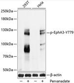 Phospho-Epha3 (Tyr779) Antibody in Western Blot (WB)