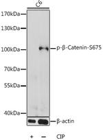 Phospho-beta Catenin (Ser675) Antibody in Western Blot (WB)