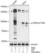 Phospho-PKC theta (Thr538) Antibody in Western Blot (WB)