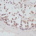 Phospho-MSK1 (Ser376) Antibody in Immunohistochemistry (Paraffin) (IHC (P))