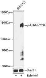 Phospho-EphA2 (Tyr594) Antibody in Western Blot (WB)