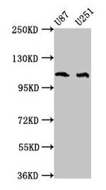 Abl2 Antibody in Western Blot (WB)