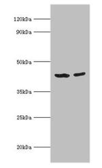 ACADS Antibody in Western Blot (WB)