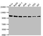 alpha Actinin 1 Antibody in Western Blot (WB)