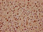 ADAR1 Antibody in Immunohistochemistry (Paraffin) (IHC (P))