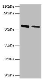 ADSL Antibody in Western Blot (WB)