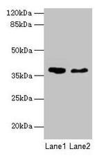 AGA Antibody in Western Blot (WB)