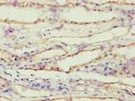 AKR1B10 Antibody in Immunohistochemistry (Paraffin) (IHC (P))