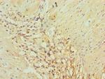 AKR1C3 Antibody in Immunohistochemistry (Paraffin) (IHC (P))