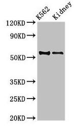 ALDH1A2 Antibody in Western Blot (WB)