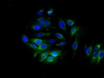 ALDH3B1 Antibody in Immunocytochemistry (ICC/IF)