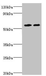 ALDH4A1 Antibody in Western Blot (WB)