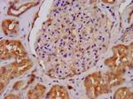 ALDH7A1 Antibody in Immunohistochemistry (Paraffin) (IHC (P))