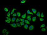 ALOX12 Antibody in Immunocytochemistry (ICC/IF)