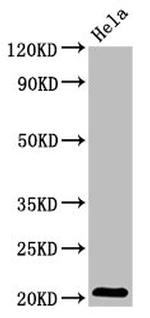 ARL1 Antibody in Western Blot (WB)