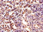 ASPH Antibody in Immunohistochemistry (Paraffin) (IHC (P))