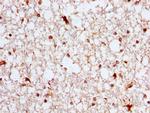 ASPH Antibody in Immunohistochemistry (Paraffin) (IHC (P))