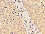 ASS1 Antibody in Immunohistochemistry (Paraffin) (IHC (P))