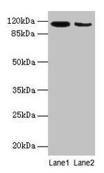 SERCA2 ATPase Antibody in Western Blot (WB)