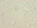 ATP5D Antibody in Immunohistochemistry (Paraffin) (IHC (P))