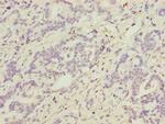 ATP5D Antibody in Immunohistochemistry (Paraffin) (IHC (P))