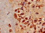 AZIN1 Antibody in Immunohistochemistry (Paraffin) (IHC (P))