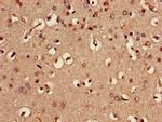 MST3 Antibody in Immunohistochemistry (Paraffin) (IHC (P))