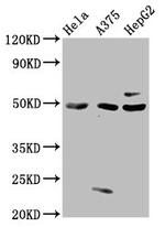 MST3 Antibody in Western Blot (WB)