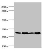 BAP29 Antibody in Western Blot (WB)