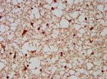 BCKDHA Antibody in Immunohistochemistry (Paraffin) (IHC (P))