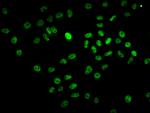 BCL9 Antibody in Immunocytochemistry (ICC/IF)