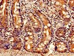 BDH1 Antibody in Immunohistochemistry (Paraffin) (IHC (P))