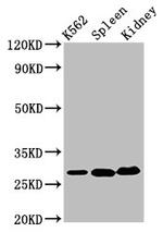 Carbonic Anhydrase I Antibody in Western Blot (WB)