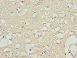 CACNB1 Antibody in Immunohistochemistry (Paraffin) (IHC (P))