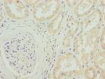 CACNB1 Antibody in Immunohistochemistry (Paraffin) (IHC (P))