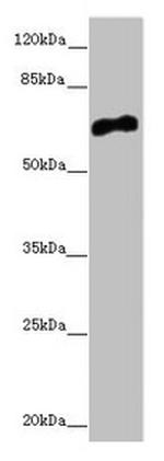 CACNB1 Antibody in Western Blot (WB)