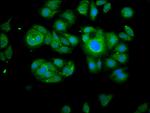 Calpain 2 Antibody in Immunocytochemistry (ICC/IF)