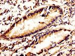 Calpain 2 Antibody in Immunohistochemistry (Paraffin) (IHC (P))